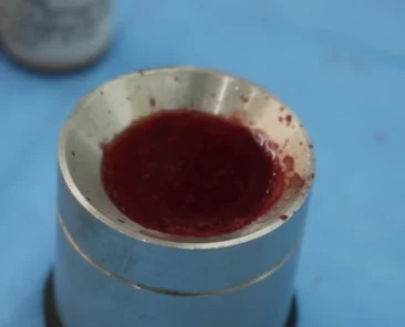 Biomaterial para enxerto ósseo embebido em sangue medular mandibular rico em células-tronco, preparado durante procedimento com o Método TCO no Hospital do Enxerto Ósseo