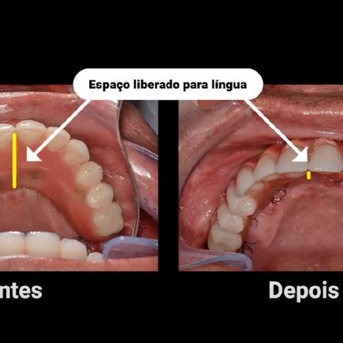caso 02 -2
