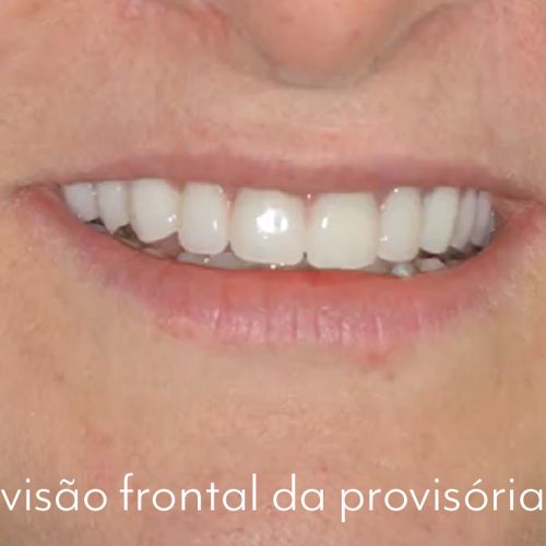 caso 05 - 3