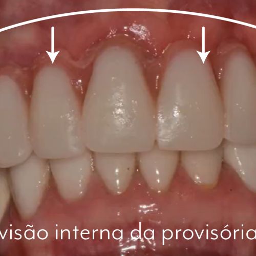 caso 05 - 5