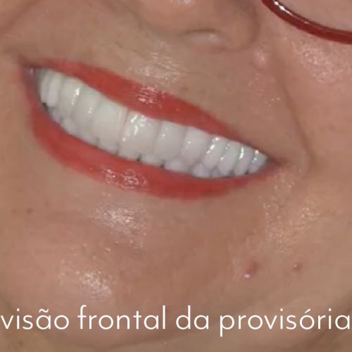caso 05 - 6