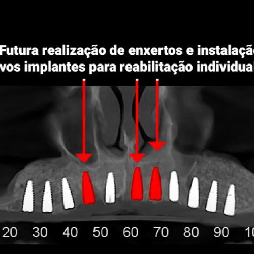 caso 06 - 4