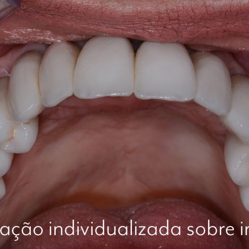 caso 06 - 8