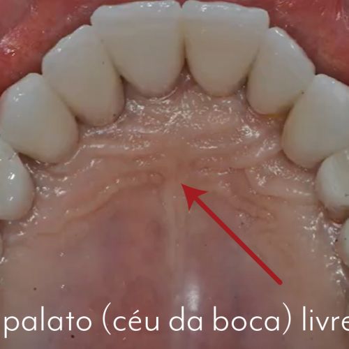 caso 09 - 3
