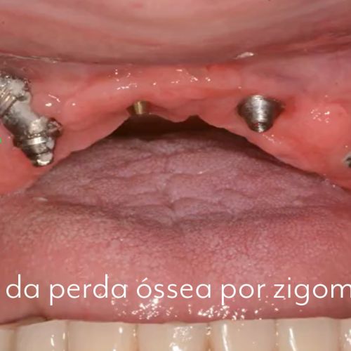 caso 09 - 3