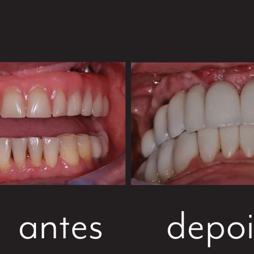 caso 09 - 5