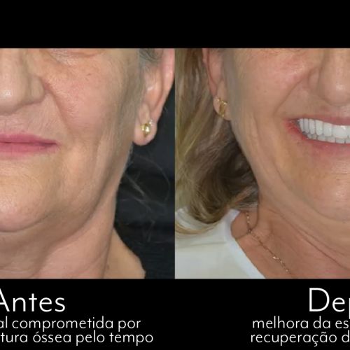caso 09 - 6