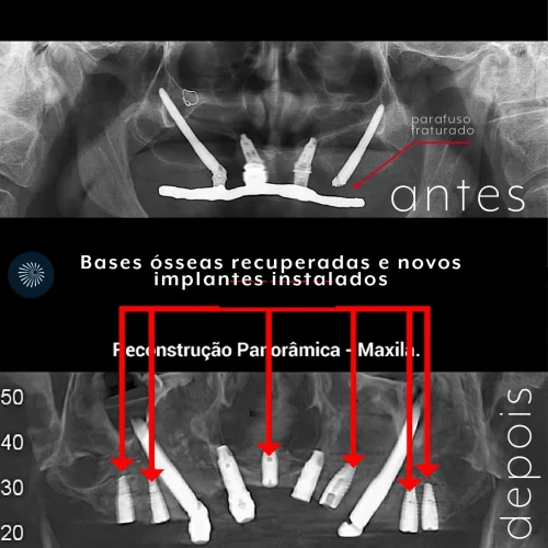 caso1capa